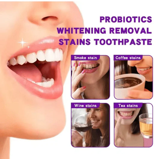 Deep Clean Toothpaste – Stain Removal, Plaque & Fresh Breath
