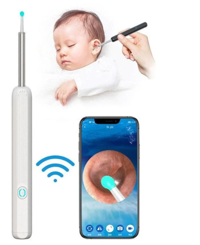 Earwax Removal Kit – Smart Visual Earwax Removal Tool 👂📱