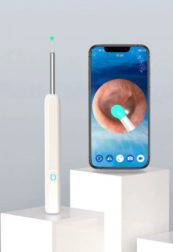 Earwax Removal Kit – Smart Visual Earwax Removal Tool 👂📱