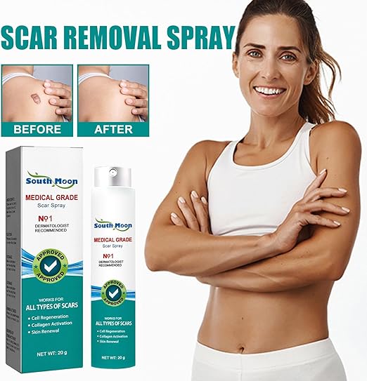 South Moon Scar Repair Spray – Acne, Surgery, Burn & Stretch Marks